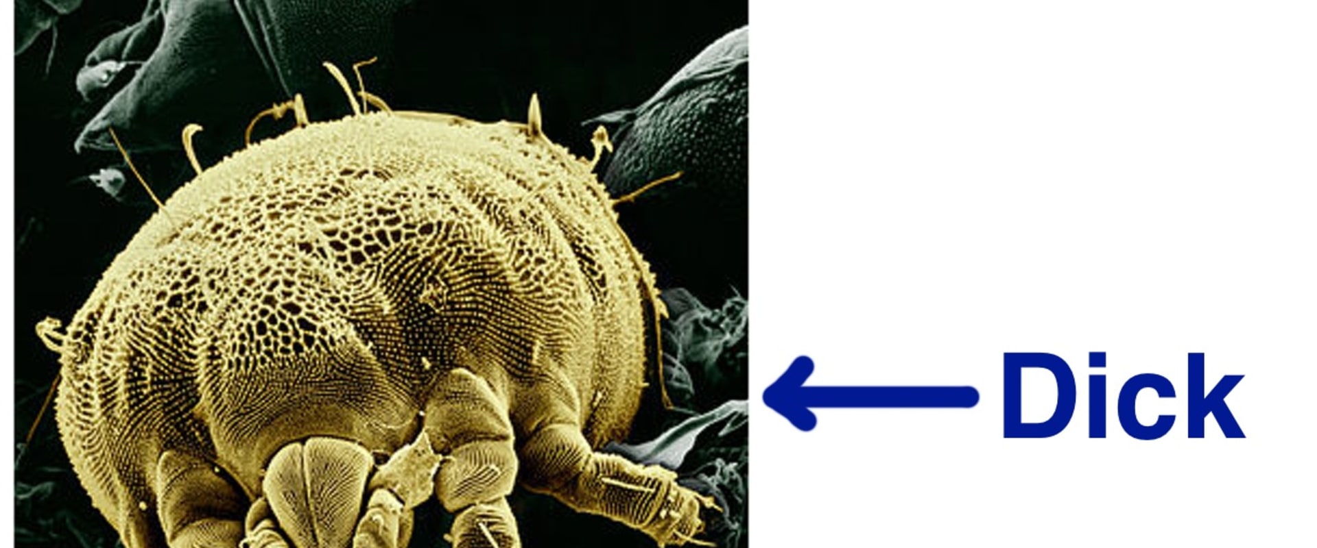 Do Dust Mites Live On Your Clothes at Mark Palmer blog